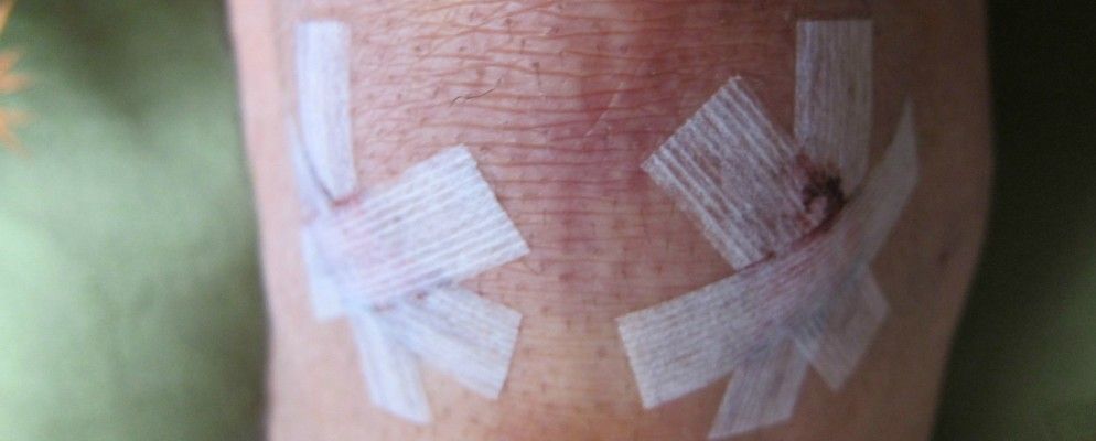 Google立即回答健康问题，RapidShare关闭[技术新闻摘要]